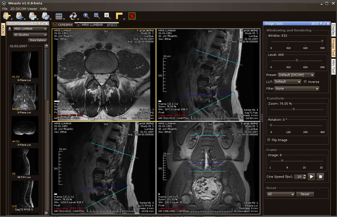 Dicom medical viewer mac free download